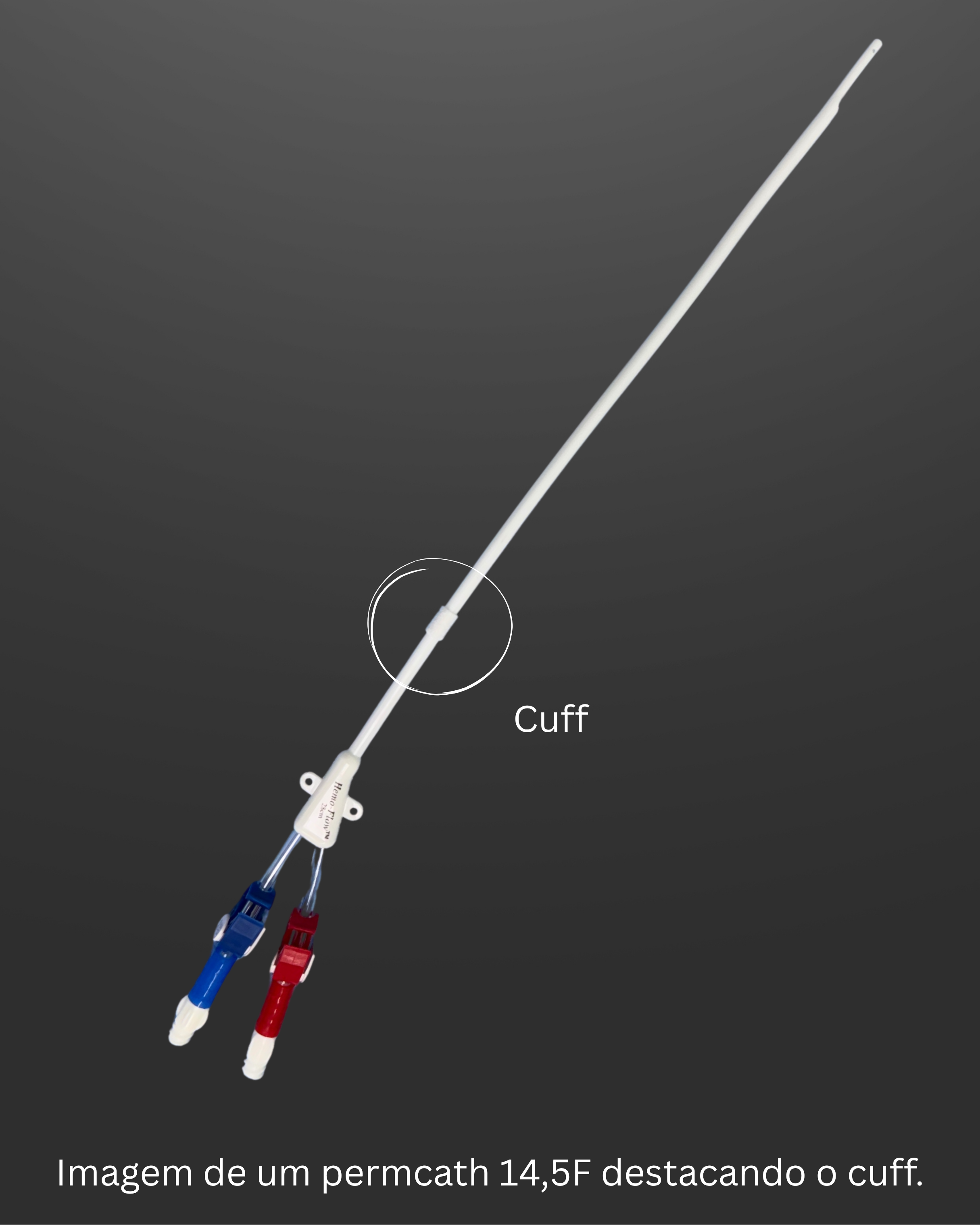 Ilustração de destacando o cuff do permcath, que é um anel de tecido que adere ao subcutâneo